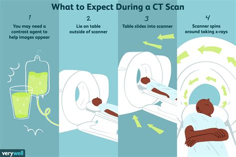 CT (Computed Tomography) Scan: Procedure and Results