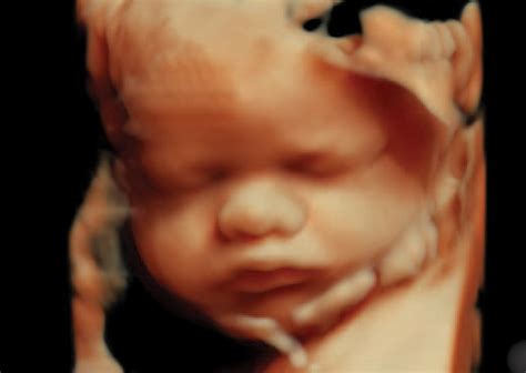 The Differences Between 2D, 3D, And 4D Ultrasounds, 56% OFF