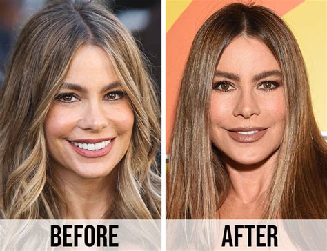 Did Sofia Vergara Get A Facelift? Here’s Why The Internet Thinks So ...