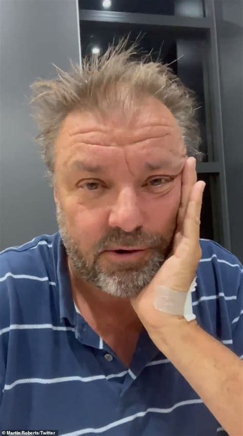 Homes Under The Hammer's Martin Roberts reveals he was hospitalised with a serious skin ...