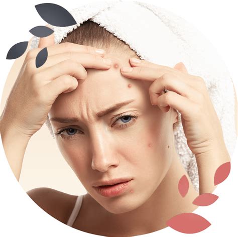 Best Acne Treatment in Malaysia | Acne Scar Removal - Debest Beauty