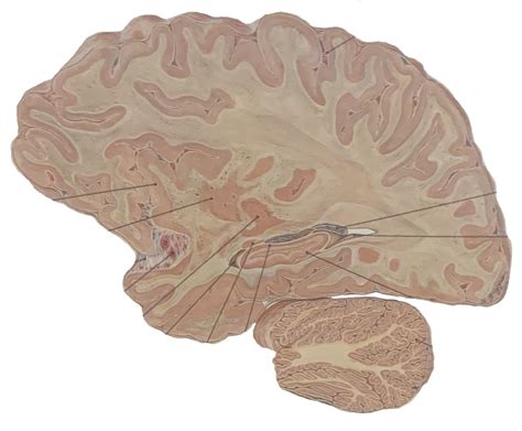 encephalon Diagram | Quizlet