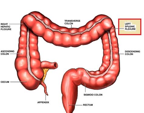 Splenic flexure syndrome | Current Health Advice, Health Blog Articles ...