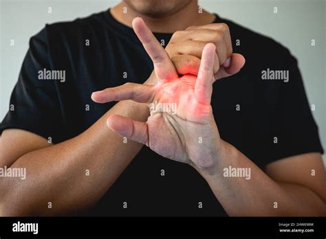 Ring finger injury hi-res stock photography and images - Alamy
