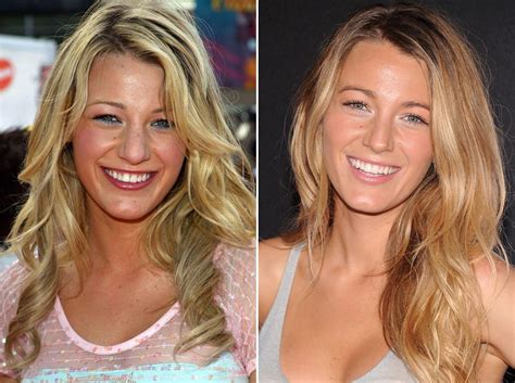 Blake Lively, Before and After | Celebrity beauty secrets, Celebrity beauty, Blake lively hair