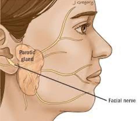 Salivary Gland Surgery - Catherine Sinclair