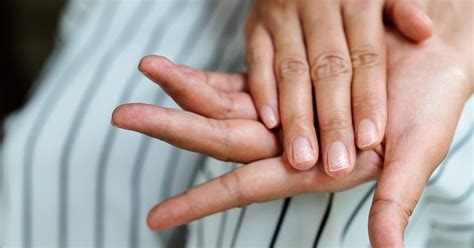 Eggshell Nails: Causes, Treatment, and When to See a Doctor