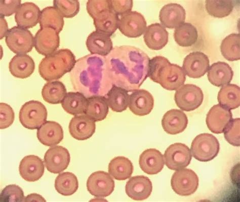 Blood cell | Magdalena Wiklund | Flickr