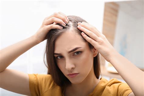 What Causes Hair Loss An Overview Kiierr | Free Nude Porn Photos