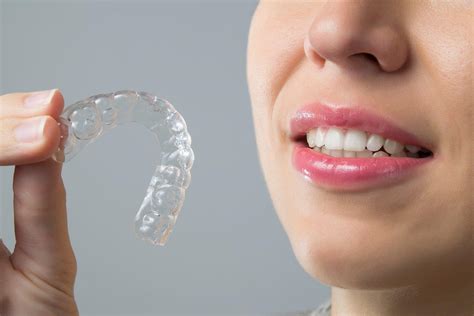 Giving Patients Straight Teeth With Invisalign in Glasgow - Homemaking ...