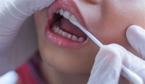 It's time for the fluoride varnish taste test – Dentistry.co.uk