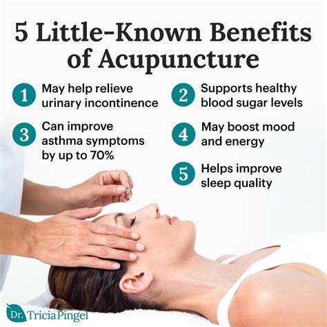 Benefits of Acupuncture | Acupuncture, Health benefits, Health