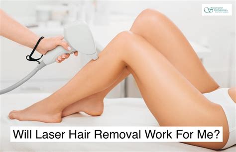 Does Laser Hair Removal Really Work? - Siperstein Dermatology Group