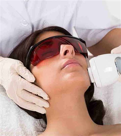 Laser Skin Tightening Treatment: How It Works And Procedure