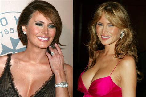 Melania Trump Jewelry: Diamond & Shoe Style [PHOTOS] – Footwear News