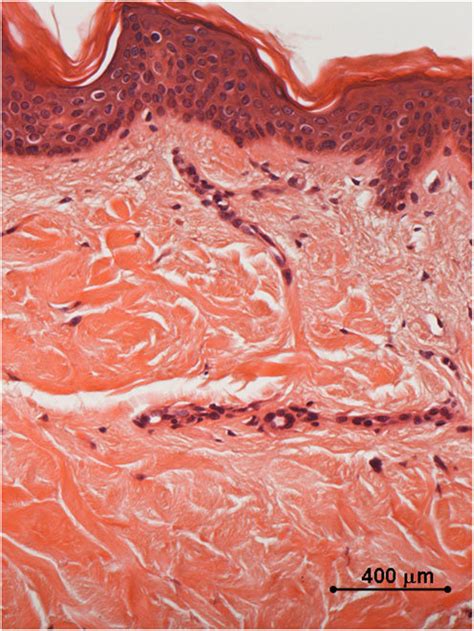 Histology of in vivo control biopsy: the collagen fibers appear thin... | Download Scientific ...