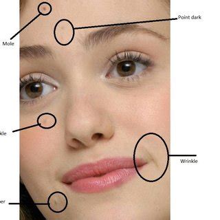 Different Types Of Dimples - Francesc Blanca