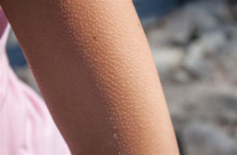 Why Do People Get Goosebumps? | Discover Magazine