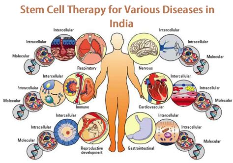 Stem Cell Therapy for Various Diseases in India with Tour2India4health - Tour2India4Health Blog