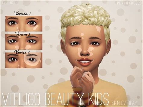 Vitiligo Beauty Skin Overlay KIDS N3 - The Sims 4 Download - SimsDomination | The sims 4 skin ...