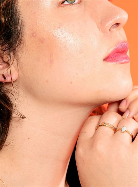 What is "orange peel skin" — & how can you get rid of it? #skincare #beauty #skin #largepores ...