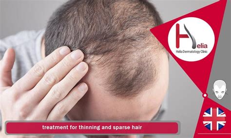 Best Treatment For Repair Sparse And Thinning Hair - helia dermatology ...