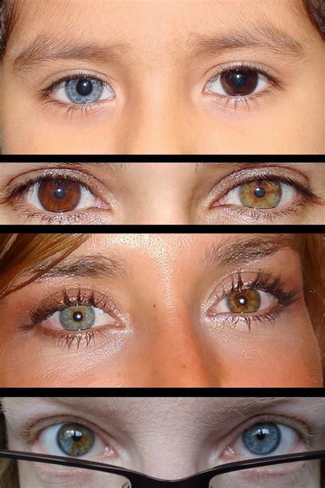 The Rarest Eye Colors In Humans