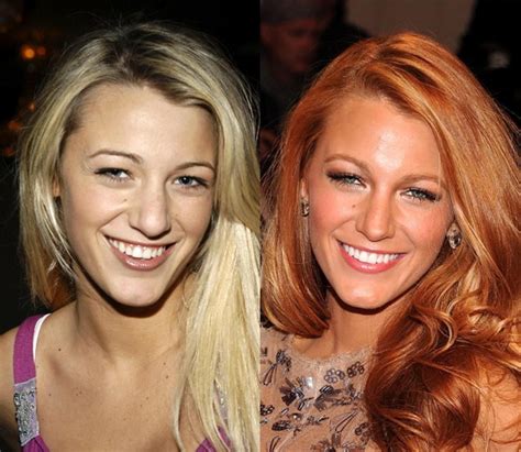 Unveiling The Truth Behind Blake Lively's Nose Job: Did She Or Didn’t She?