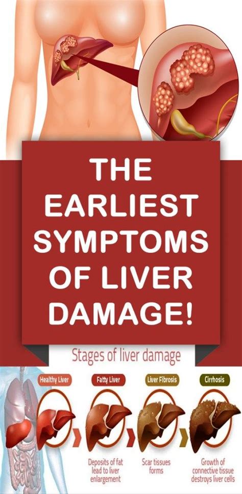 The Earliest Symptoms Of Liver Damage! - crishealth