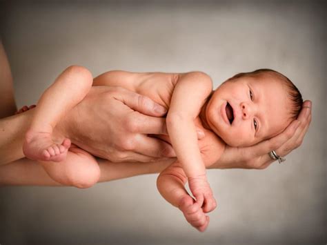 What are the most common types of birth injuries?