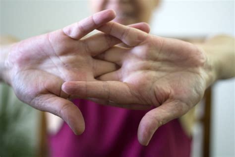 How to Stop Cracking Your Knuckles for Good in 3 Easy Steps - Desert Hand Therapy