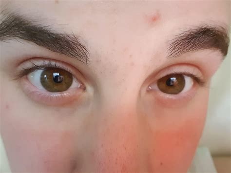 Which color is this and are my eyes unattractive because of upper eyelid exposure? : r/eyes