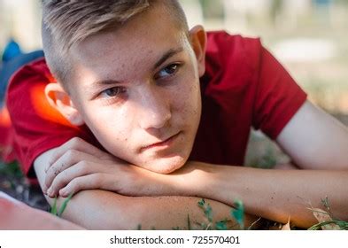 Portrait Young Boy Pimples On Face Stock Photo 725570401 | Shutterstock