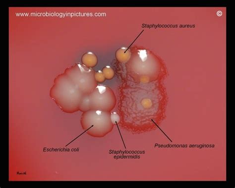 Pseudomonas Aeruginosa Colony Morphology