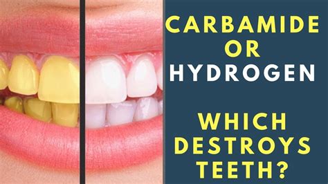 Carbamide Peroxide vs Hydrogen Peroxide Whitening: Which One Will ...