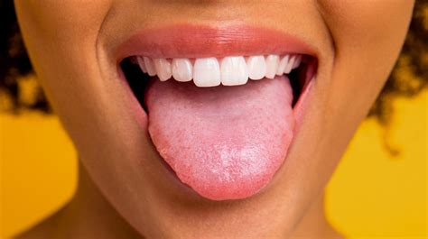 Healthy Tongue Color