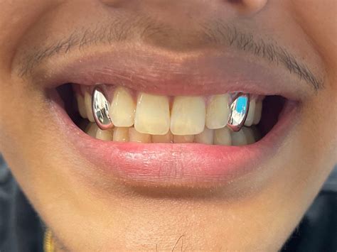 2x Sterling Silver 925 Grillz Any Teeth UK Worldwide Shipping - Etsy