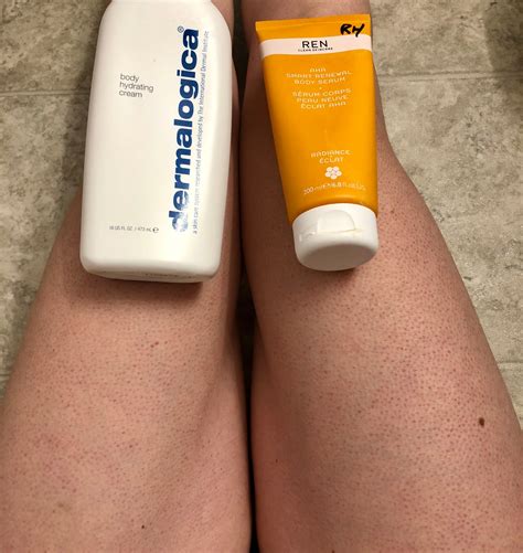 Keratosis pilaris - Finally a product th... - Beauty Insider Community