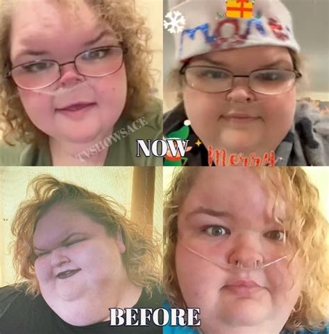 Tammy Slaton Update: Reveals SHOCKING Weight Loss, See Pic