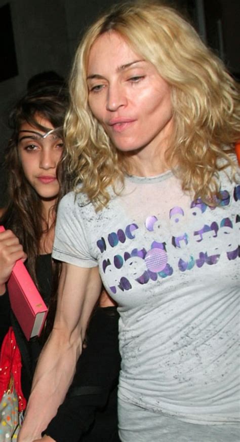 Celebrity Madonna - plastic surgery, photos, video