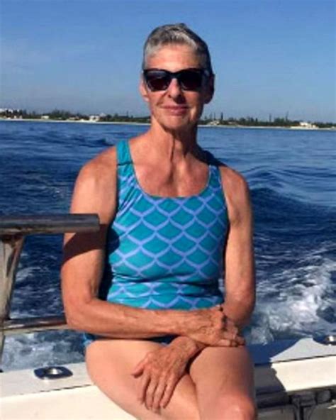 73-year-old woman recounts shark attack in Bahamas: 'Like a truck hit me' | Flipboard