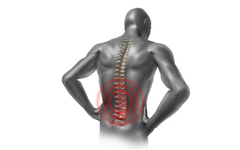 Spondylosis - Know Your Doctor