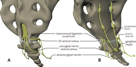 Imaging Coccygeal Trauma and Coccydynia | RadioGraphics