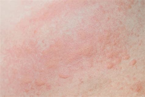 If you spot these red dots on your skin, here's what they mean