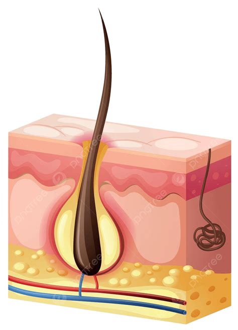 Hair Growing From Under Skin Clipping Human Body Cancer Vector ...