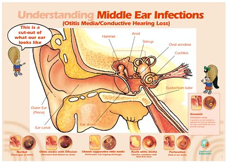 MD ☞☆☆☆ Middle ear infections. | Middle ear, Ear infection, Medical training