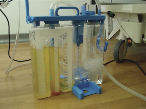 Figure 1 from Managing a chest tube and drainage system. | Semantic Scholar