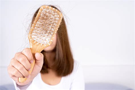 PCOS Hair Loss: Causes, Home Remedies and Treatment