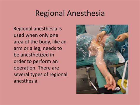 PPT - Types of Anesthesia PowerPoint Presentation, free download - ID ...