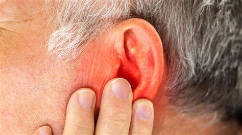 What Caused This Patient's Recurring Eye and Ear Inflammation? | MedPage Today